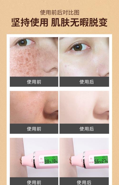 祛斑护肤品怎么选才有效?-图2 祛斑护肤品怎么选才有效?-图2