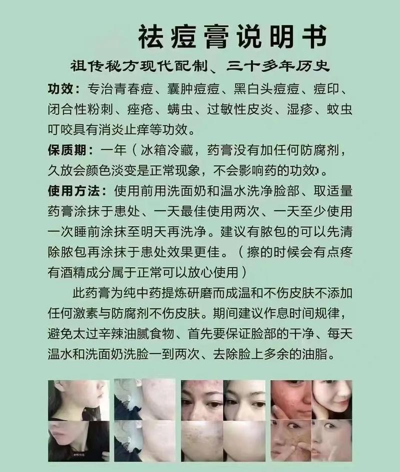 祛痘好评怎么写才能吸引人?-图2 祛痘好评怎么写才能吸引人?-图2