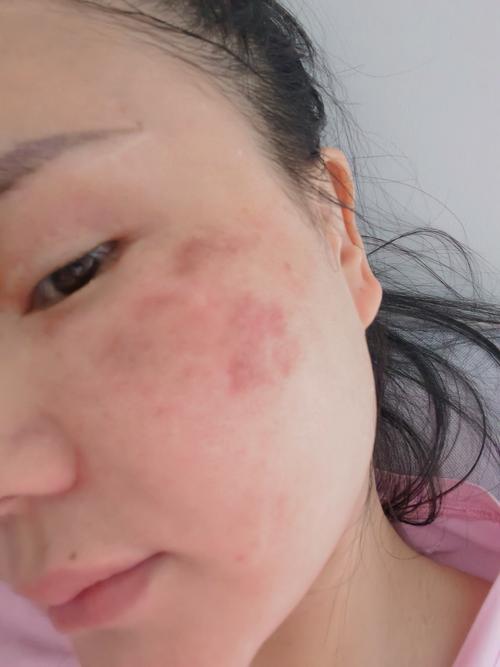 皮肤有斑，该用啥护肤品？-图3