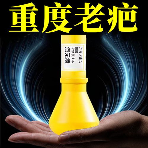 痘印黑色怎么快速祛除？-图2