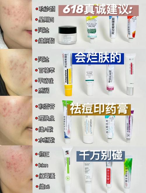 祛痘该喝中药还是西药?-图1 祛痘该喝中药还是西药?-图1