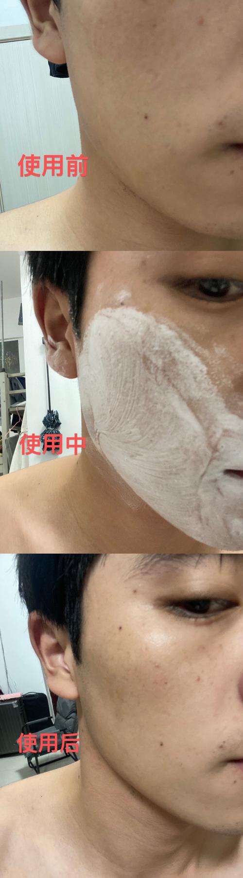 男士美白护肤品真的有效吗？-图3