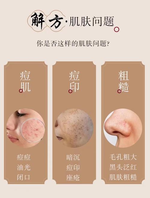 三七粉祛痘面膜怎么用才有效？-图2