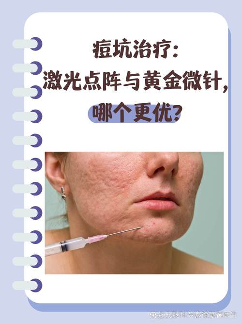 强脉冲光到底能不能祛闭口痘？-图2