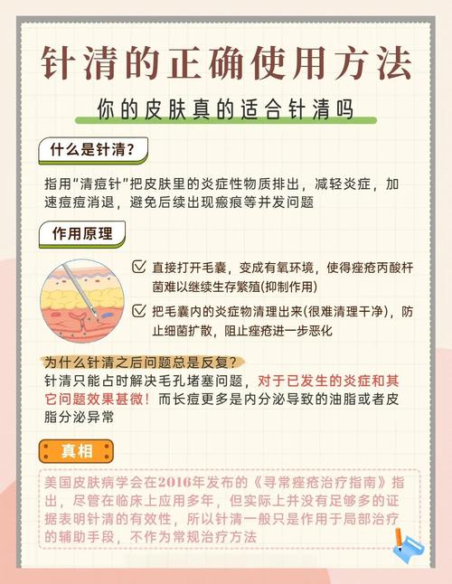 针清祛痘怎么缓解疼痛？-图2