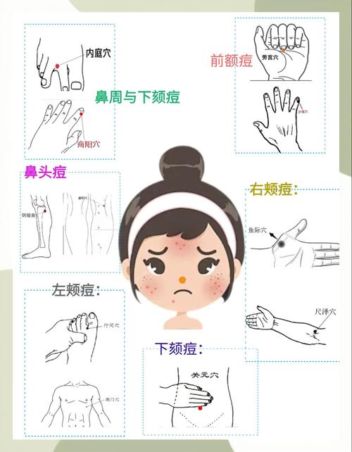 蜂蜜加盐祛痘使用方法-图3