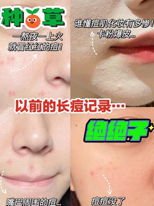 微针后多久能护肤？-图3