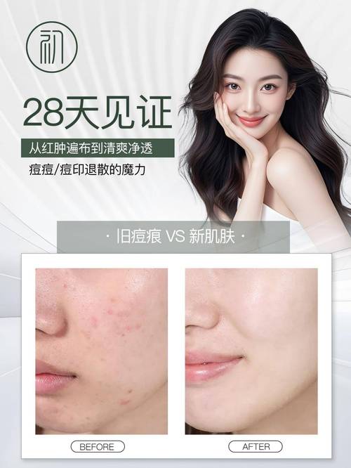 祛痘系列到底哪个效果好？-图3