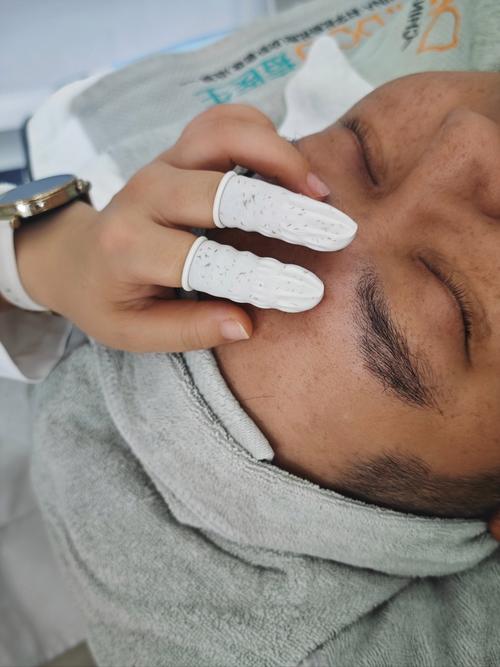 男人祛痘师，是温柔担当还是另类选择？-图2