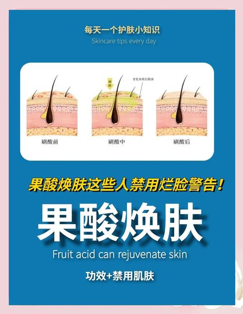 果酸换肤祛痘后为何会反弹？-图1