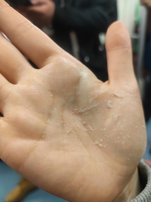 护肤品搓泥是咋回事？-图3