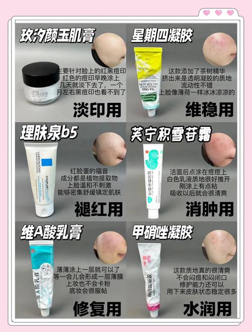 理肤泉特安和祛痘产品功效有何不同？-图2