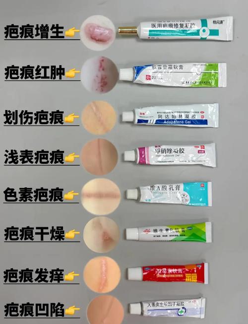 去疤痕护肤品，到底哪款才真正有效？-图2