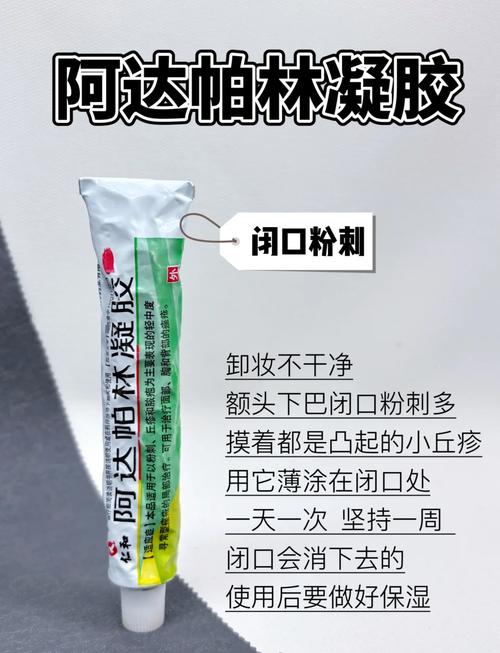 pair祛痘膏能涂炎症痘痘吗？-图2