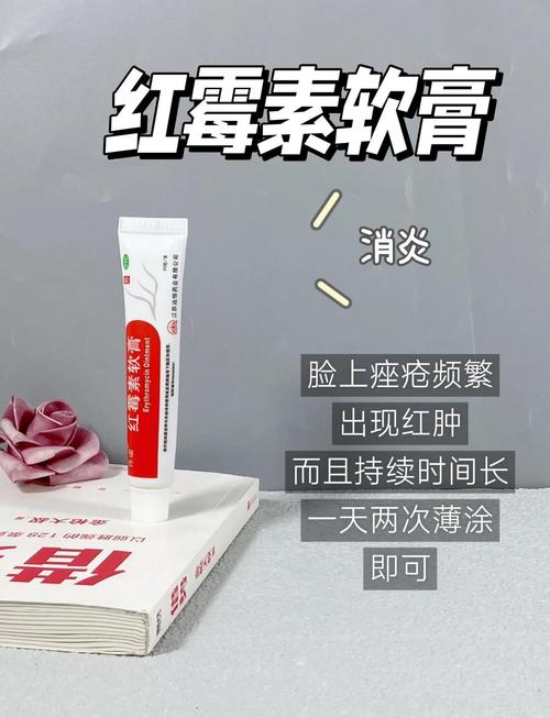 pair祛痘膏能涂炎症痘痘吗？-图3