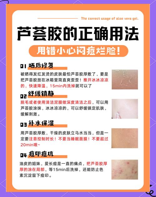 绿茶芦荟能祛痘印吗？-图2