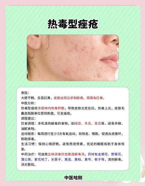 祛痘要注意哪些问题？-图1