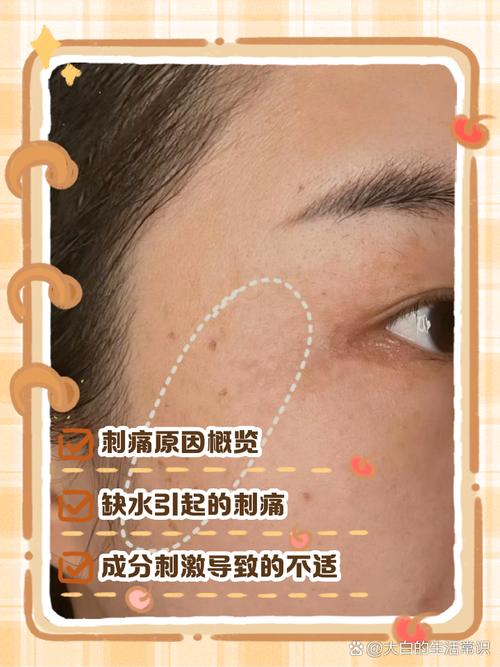 护肤品擦脸刺痛是过敏了吗？-图1