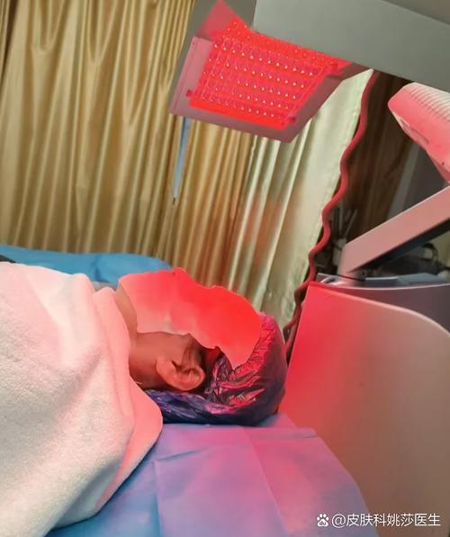 医院红蓝光祛痘后多久能沾水?-图1 医院红蓝光祛痘后多久能沾水?-图1