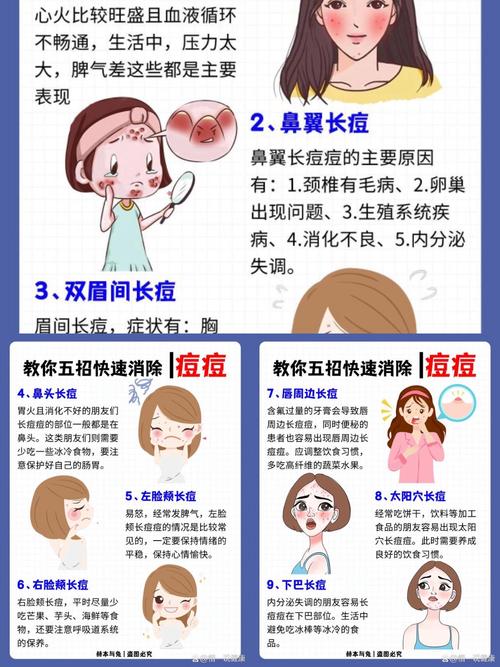 如何快速祛痘消灭?-图1 如何快速祛痘消灭?-图1