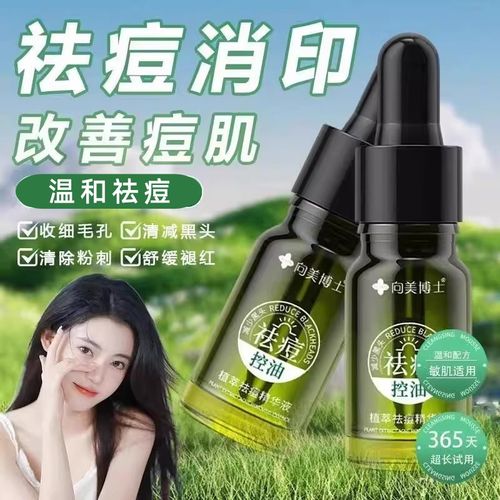 绿色瓶子祛痘山东产品效果怎么样？-图2
