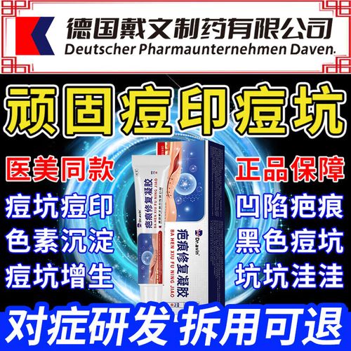 德国女孩祛痘步骤有哪些？-图2