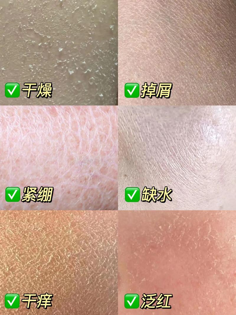 不合格护肤品怎么判断?避坑指南看这里!-图2 不合格护肤品怎么判断?避坑指南看这里!-图2