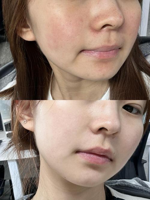 护肤品涂完脸黏腻怎么办？-图1