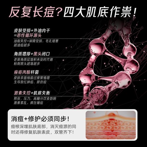 月见草真的能祛痘吗?-图3 月见草真的能祛痘吗?-图3