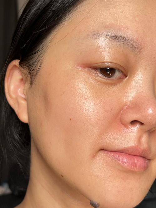 护肤品涂完脸为什么油油的？-图2