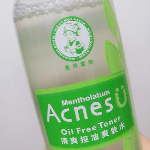 控油祛痘爽肤水怎么选？-图1