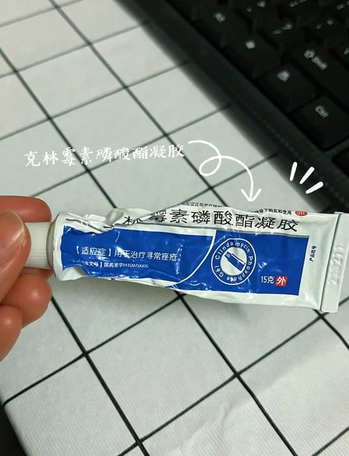 自制外用西药祛痘药膏安全吗？-图2