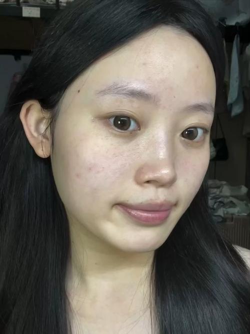 妆点网曝光的祛痘产品,真的靠谱吗?-图3 妆点网曝光的祛痘产品,真的靠谱吗?-图3