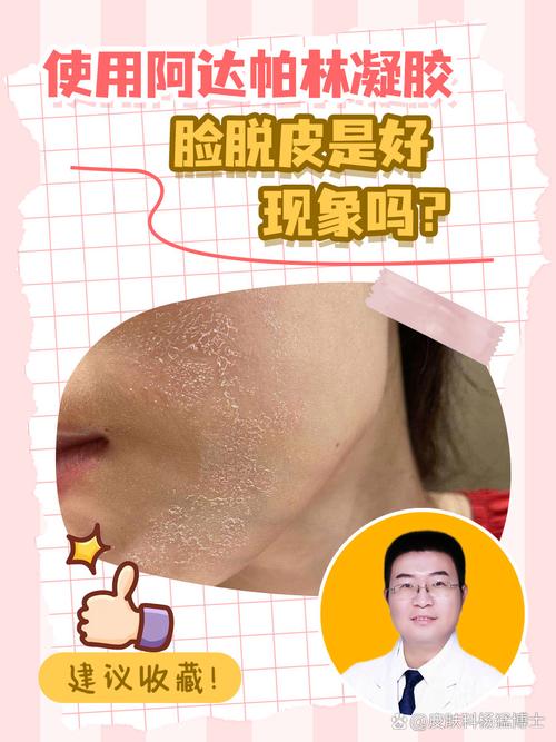 脸蜕皮,用什么护肤品修复好?-图2 脸蜕皮,用什么护肤品修复好?-图2