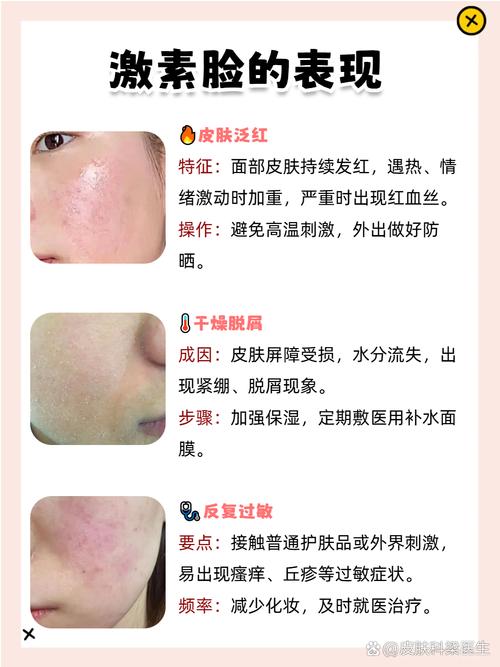 脸过敏可以涂护肤品吗-图1 脸过敏可以涂护肤品吗-图1