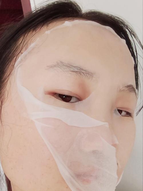 孕妇自制消炎祛痘面膜安全吗？-图2