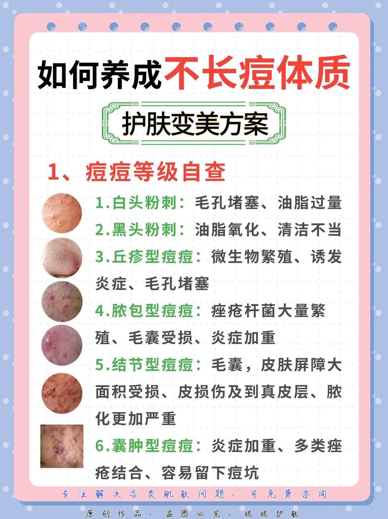 如何快速祛痘不留痘印？-图1