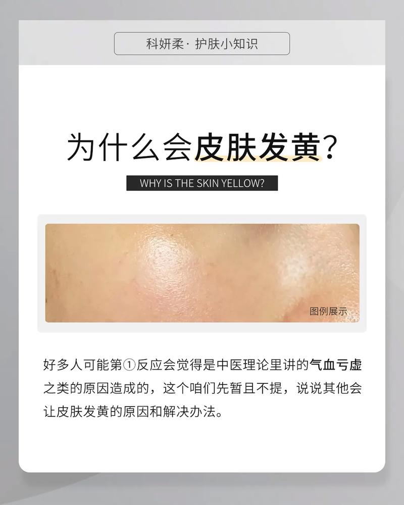护肤品用后脸发黄是为何？-图1