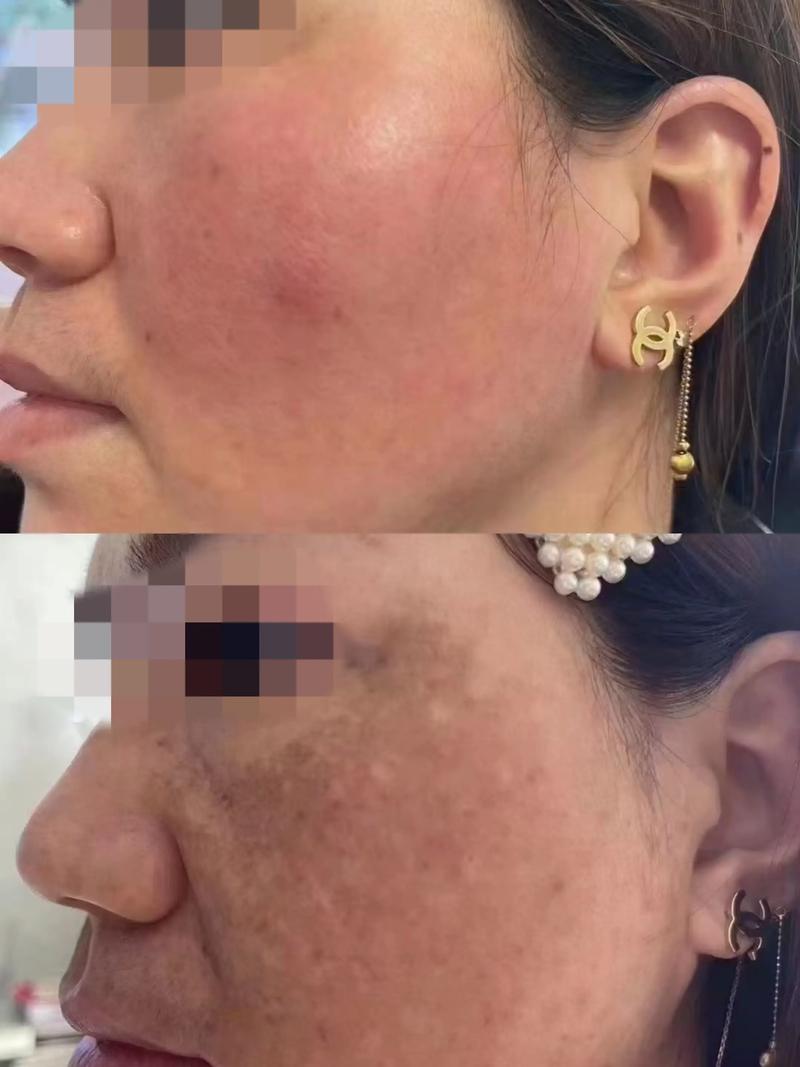 不含铅汞的护肤品存在吗？-图1