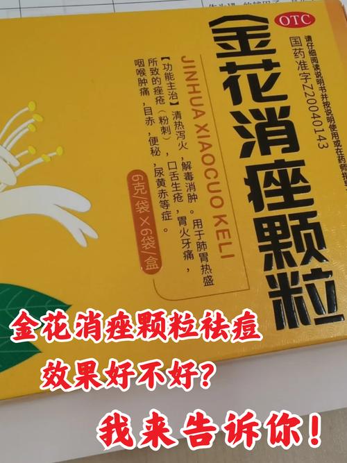祛痘该选中药还是西药？-图2