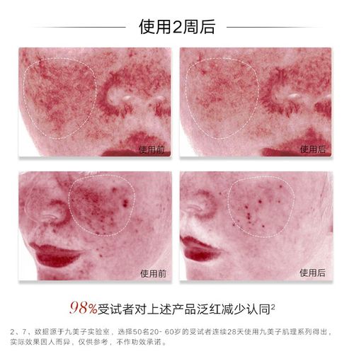 九美子护肤品效果到底好不好？-图1