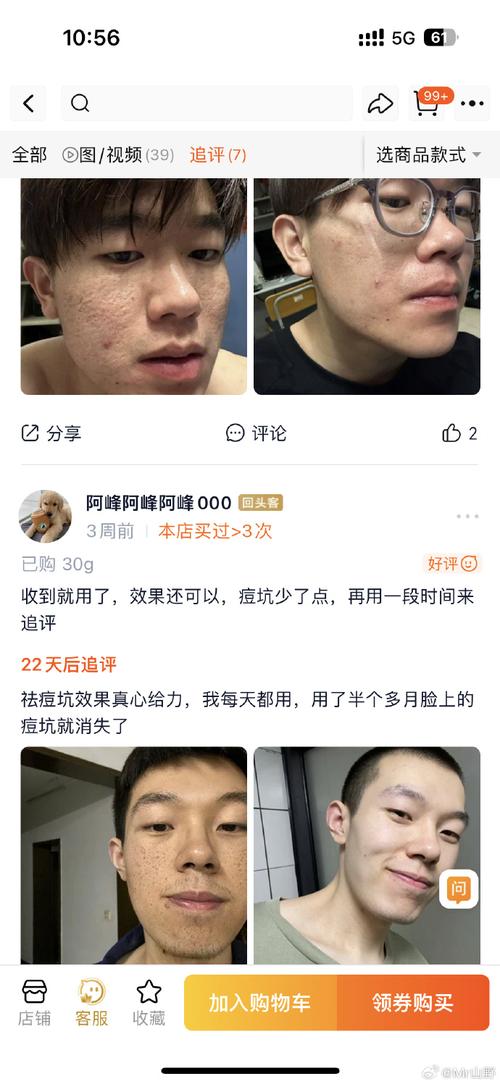 VC和VE搭配祛痘印，效果到底怎么样？-图2