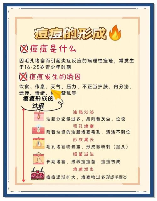 男生祛痘护肤该怎么做？-图3