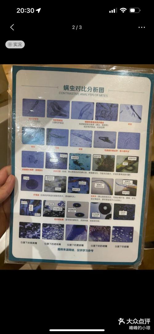 Skin79祛痘效果真的好吗？-图1