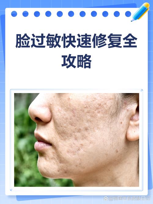 护肤品过敏后能自行恢复吗？-图1