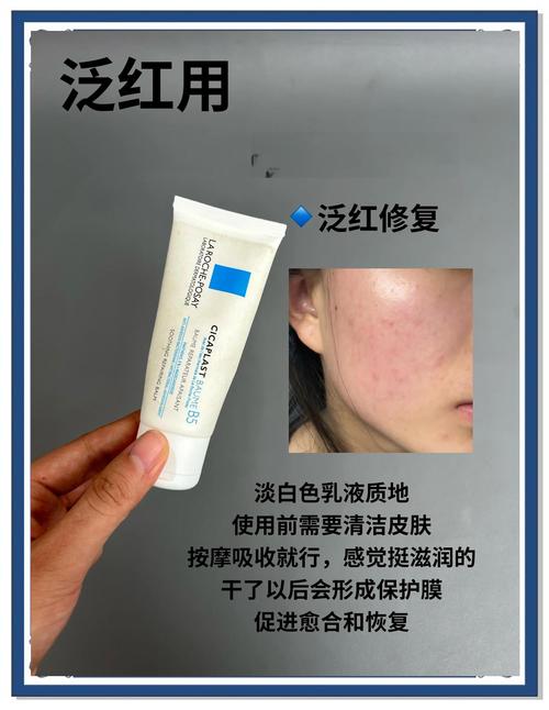 油皮祛痘选乳液，控油还是致痘？-图2