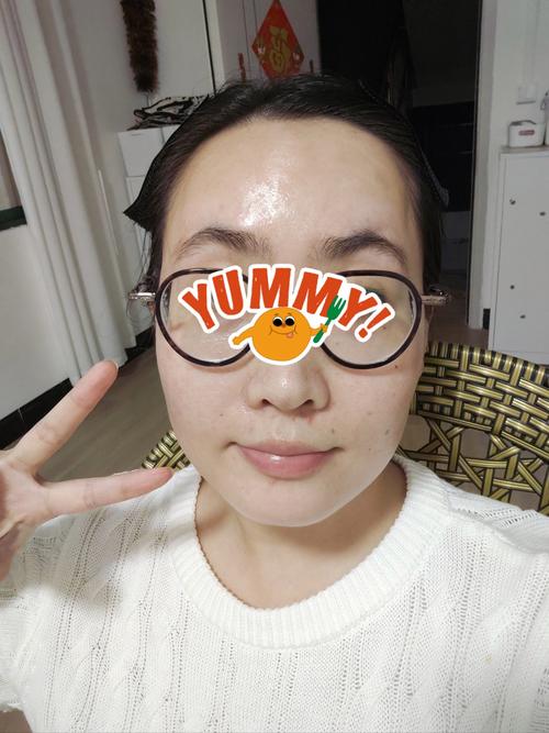 激光祛痘后该用什么水洗脸？-图1