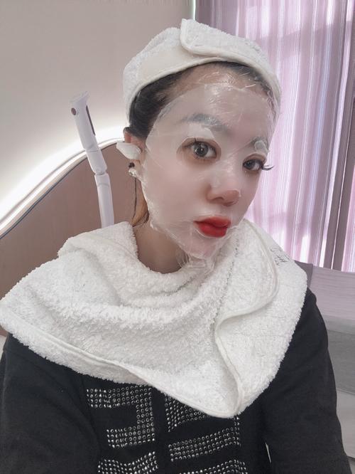 激光祛痘后该用什么水洗脸？-图2