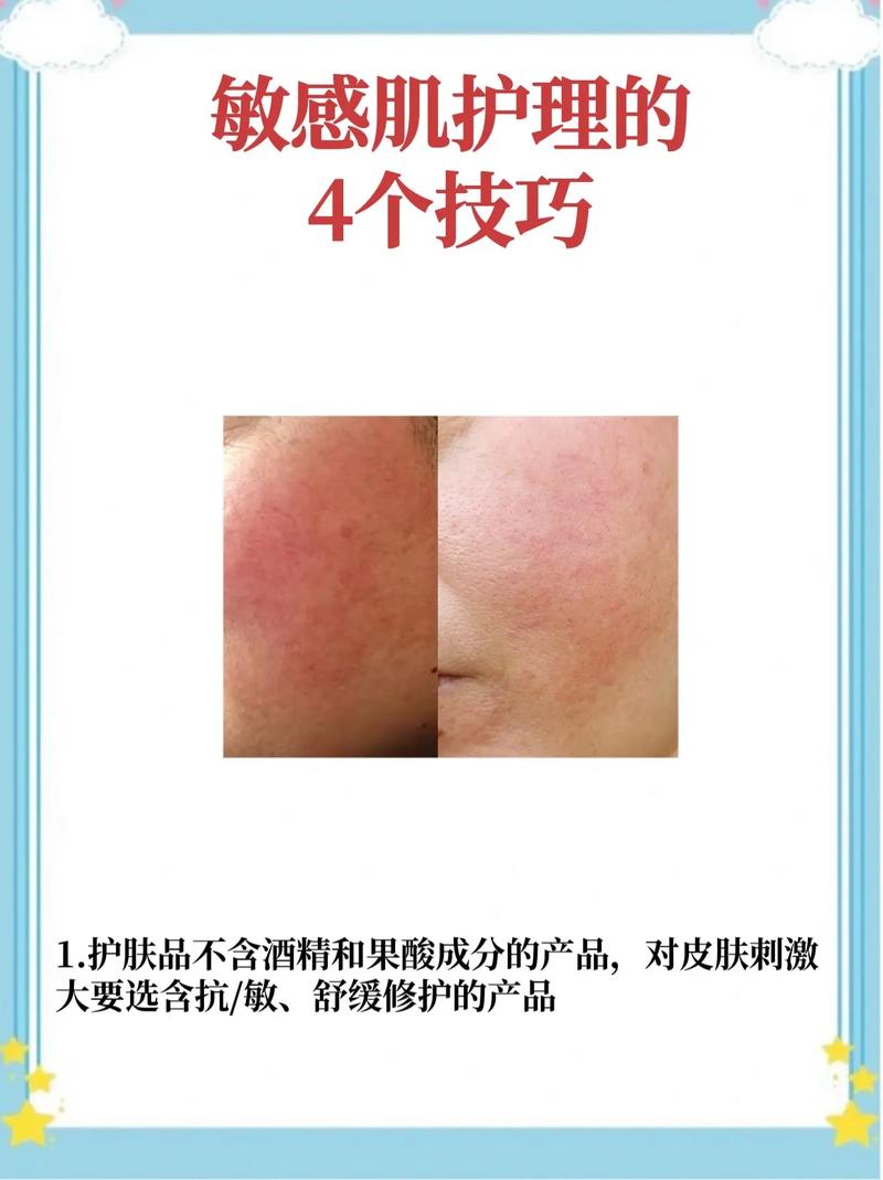 过期护肤品擦了会伤脸吗？-图2