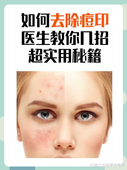 自然美为何会增痘而非祛痘？-图2